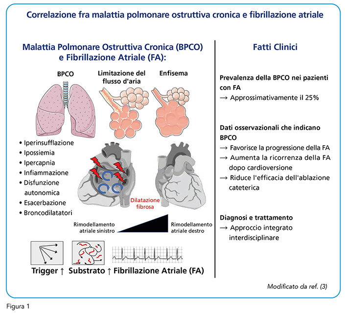 Figura 1. Correlazione fra malattia polmonare ostruttiva cronica e fibrillazione atriale.